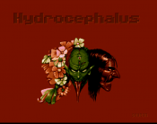 Hydrocephalus 2